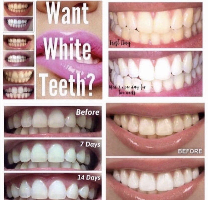 Whitening Fluoride Toothpaste with Vanilla Mint - 3.9 oz, Brighten & Protect