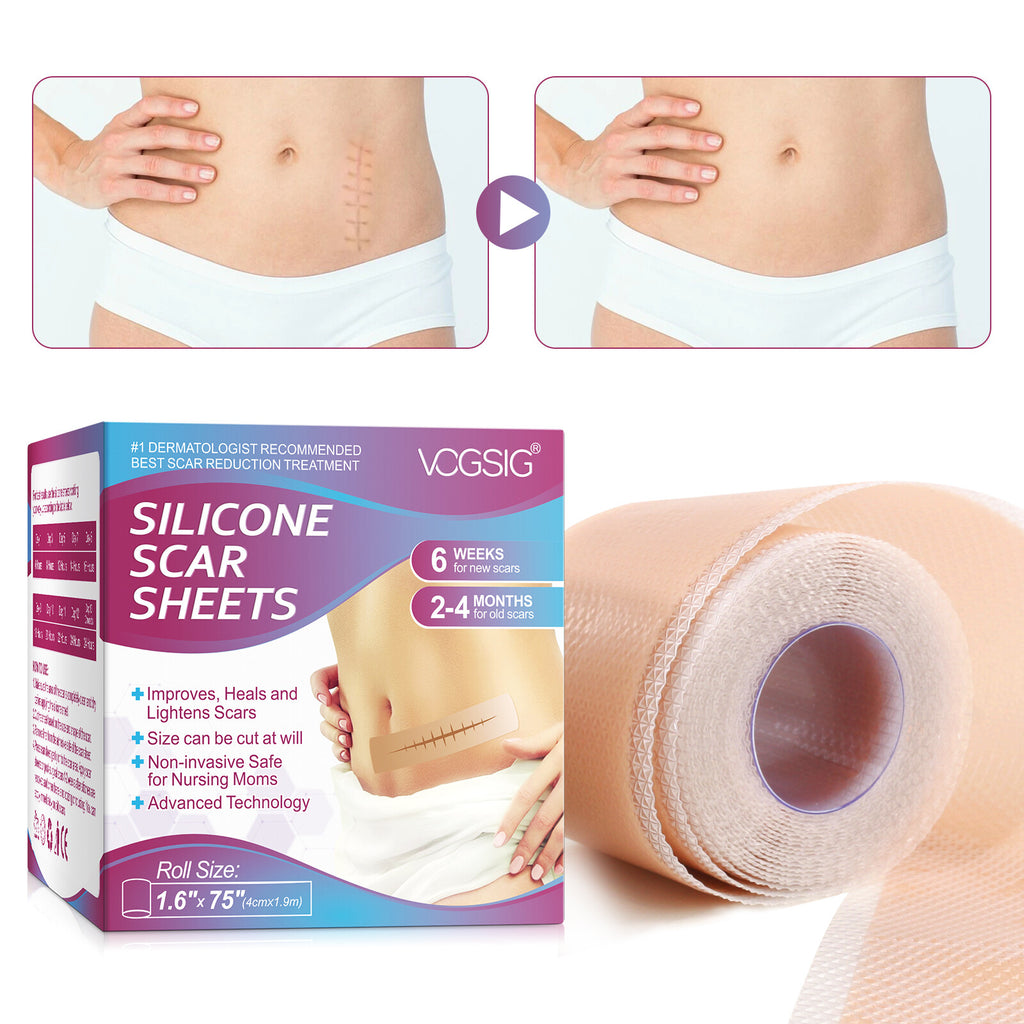 Scar Removal Silicone Tape for Hypertrophic Scars & Keloids - 1.6" x 60"-150"