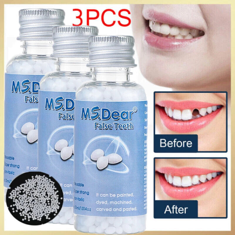 3PCS Tooth Repair Beads Granules - Moldable Temporary Dental Pellets for Broken & Gaps