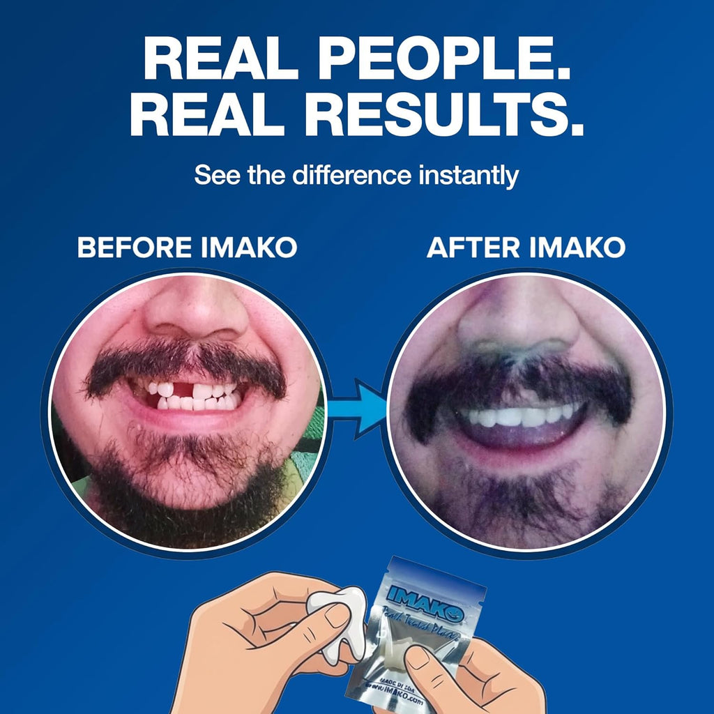 Temporary Moldable Tooth Kit - Natural Color, Reheat & Reshape, Made in USA