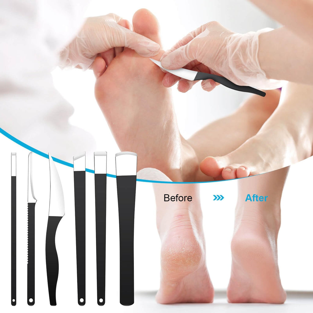 Pedicure Knife Set with Storage Box - Foot Callus and Ingrown Toenail Removal Kit