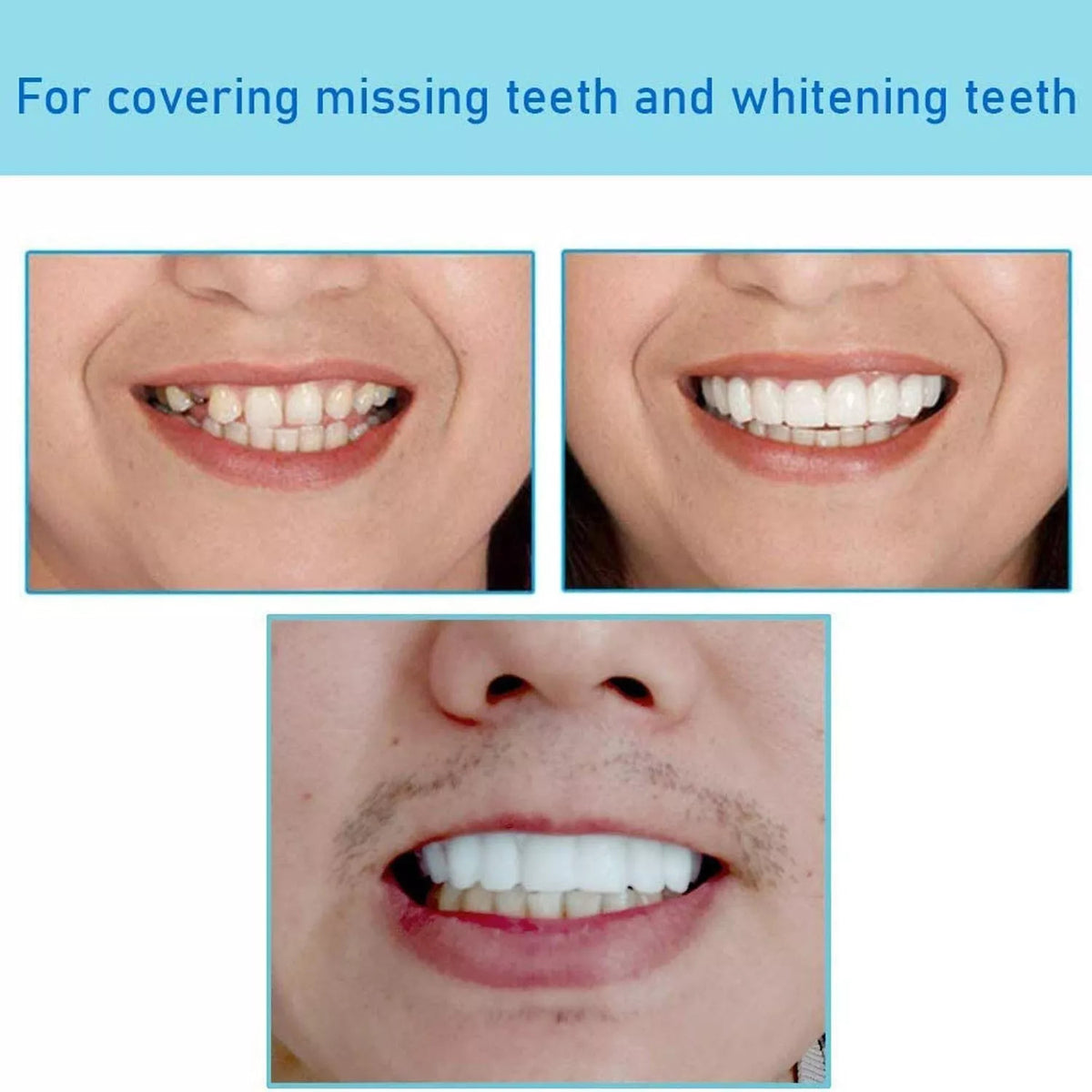 Snap-On Upper and Lower Dental Veneers Set for Adults - Reusable Teeth Covers