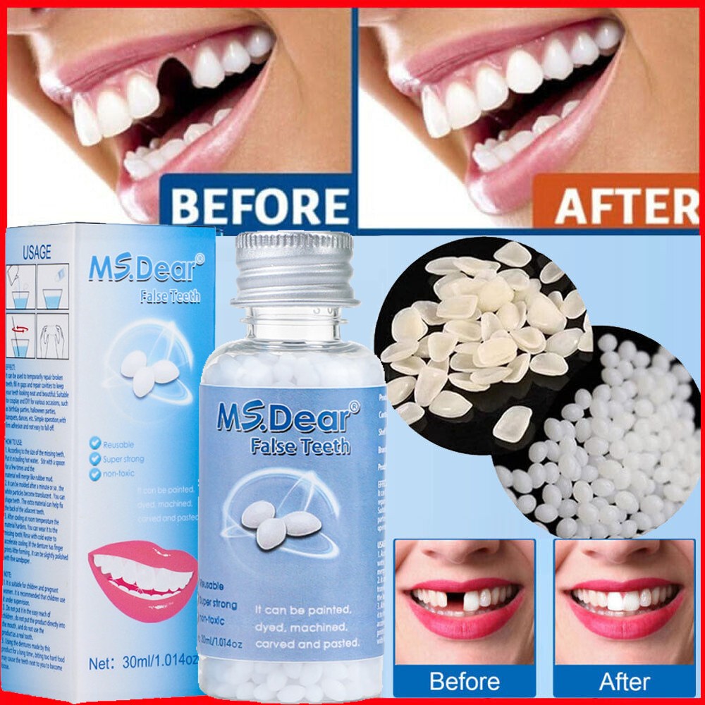 Teeth Repair Kit Moldable False Tooth Beads Reusable Temporary Fix