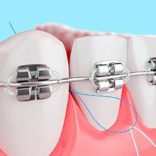 Dental Floss Threaders 200PCS for Braces & Bridges - Oral Care Tool Set
