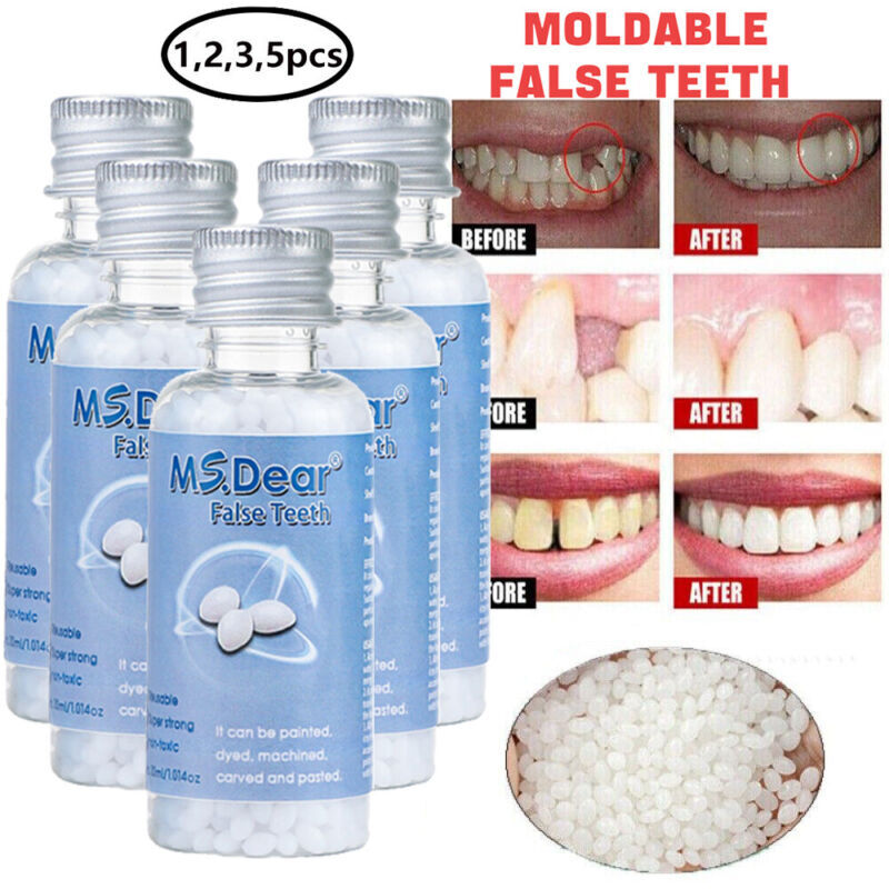 Teeth Repair Kit - Temporary Missing & Broken Tooth Replacement Set - Multiple Quantities