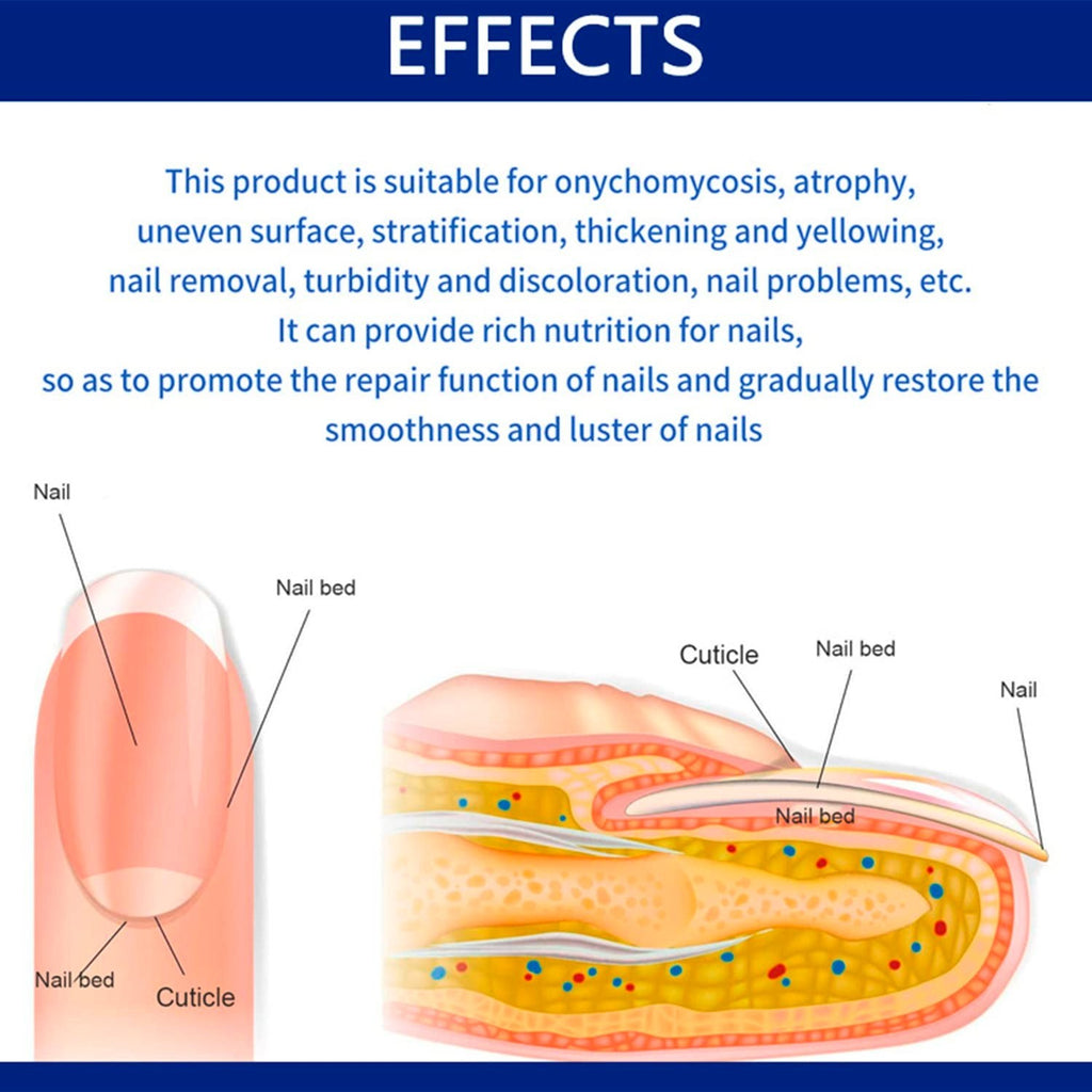 Nail Repair Cream for Damaged Nails - Hydrates & Restores 20g