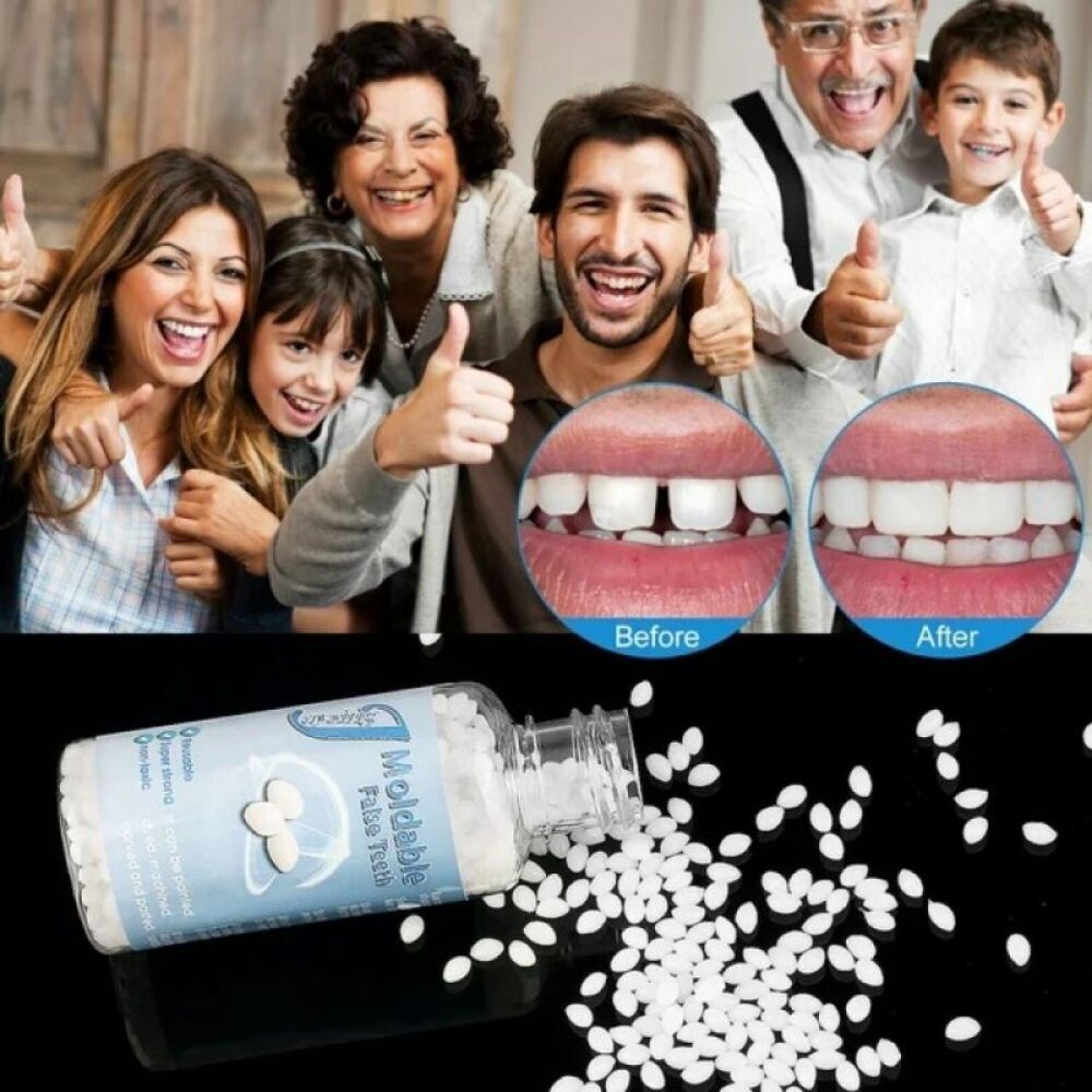 Temporary Dental Repair Kit for Broken Teeth & Cavities - Reusable Teeth Filler