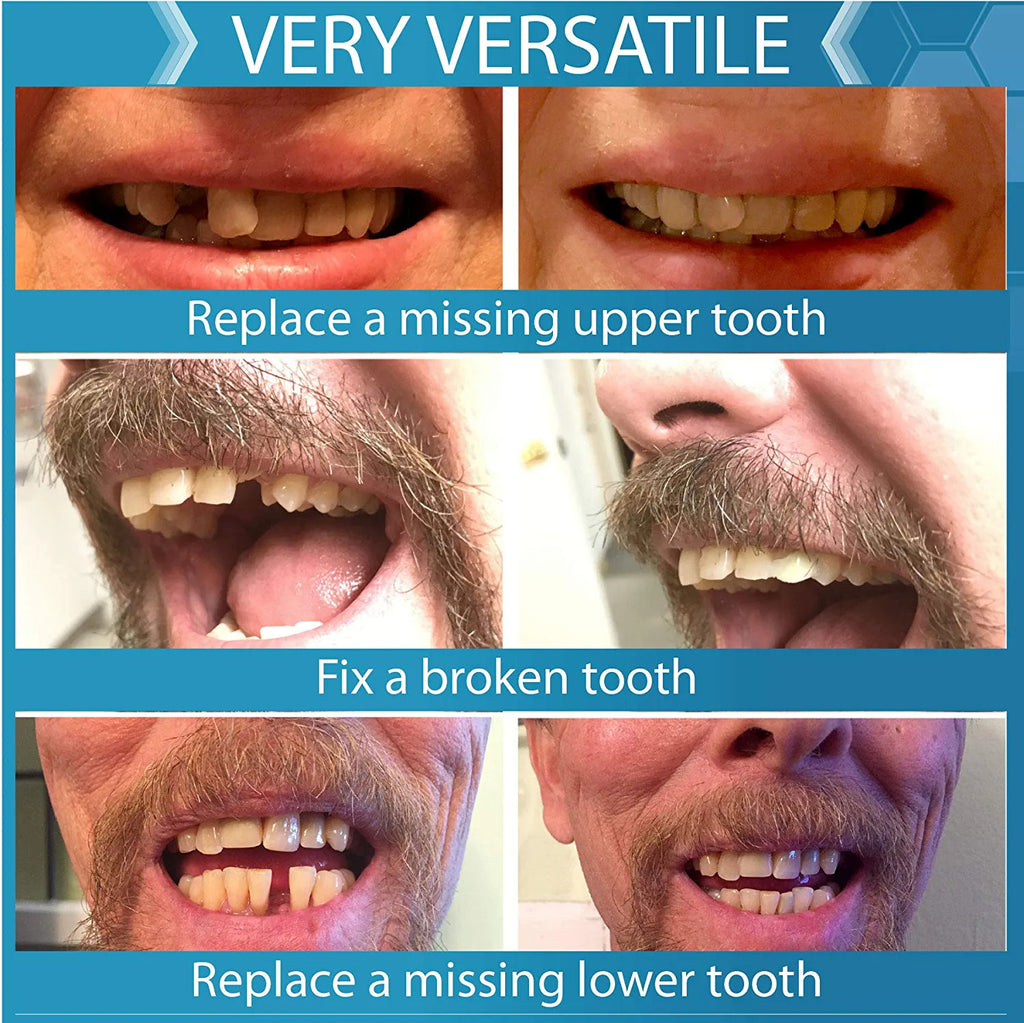 Temporary Tooth Replacement Kit for Missing Teeth - Natural Look, Multi Shade