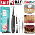 Electric Ultrasonic Tooth Cleaner Tartar & Plaque Remover Kit