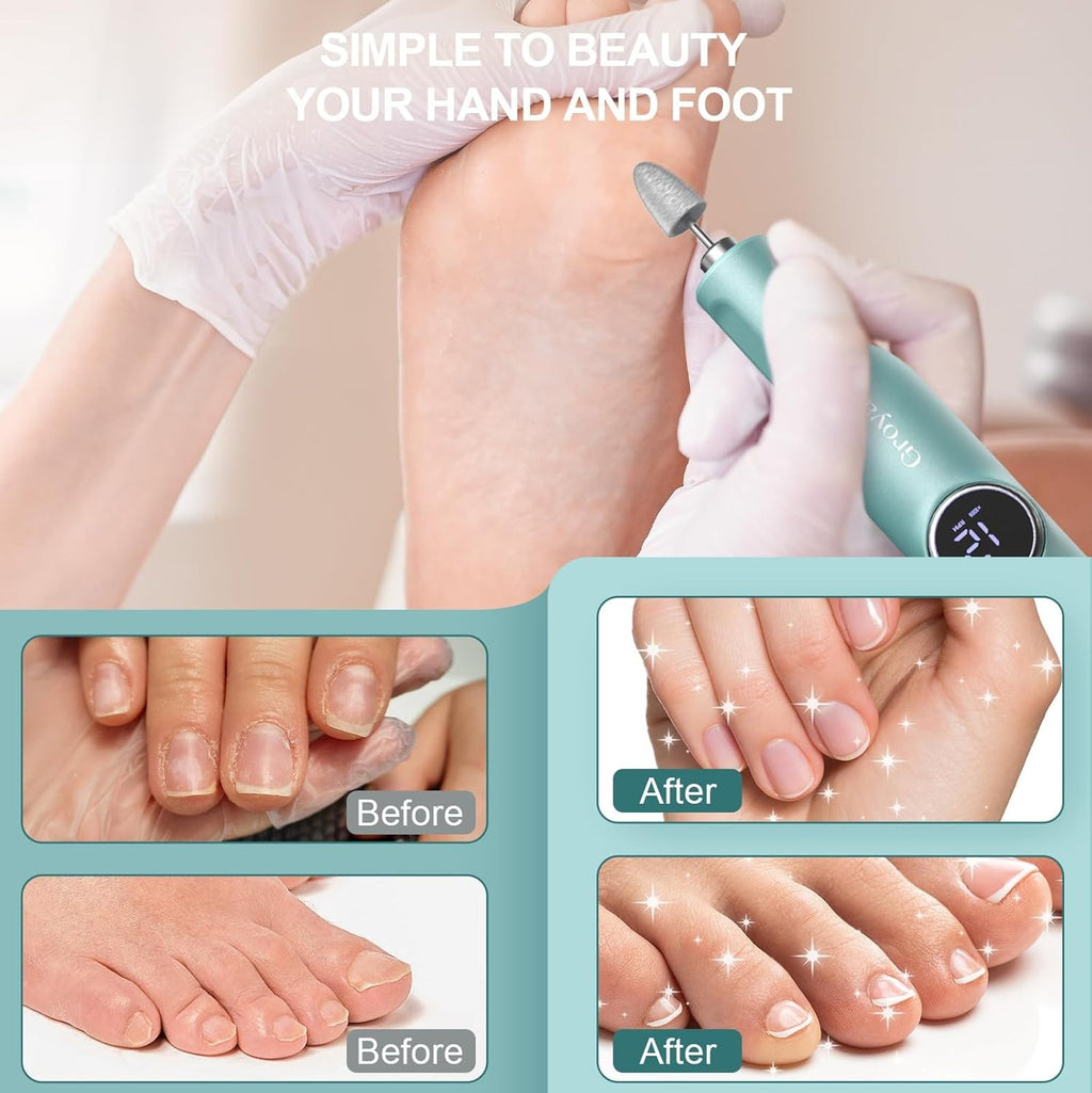 Electric Foot Callus Remover & Pedicure Tool - Cordless Dead Skin Exfoliator