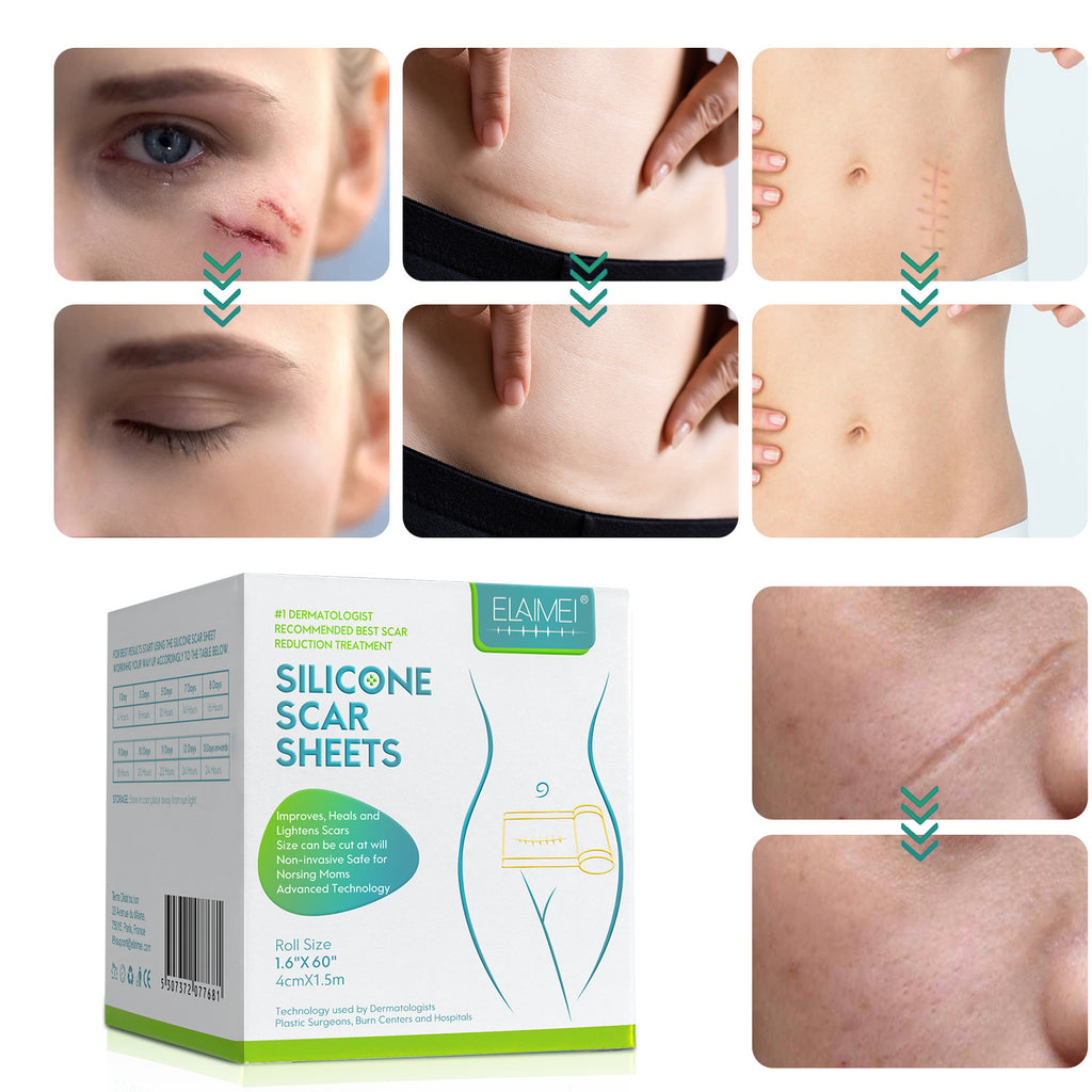 Silicone Scar Removal Tape for Hypertrophic & Keloid Scars - 1.6" x 60-150"