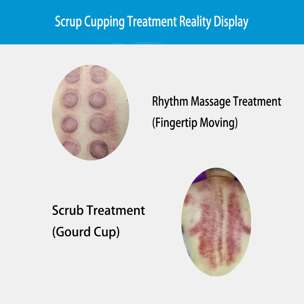 Vacuum Therapy Body Massage Machine for Breast & Butt Enhancement Pain Relief