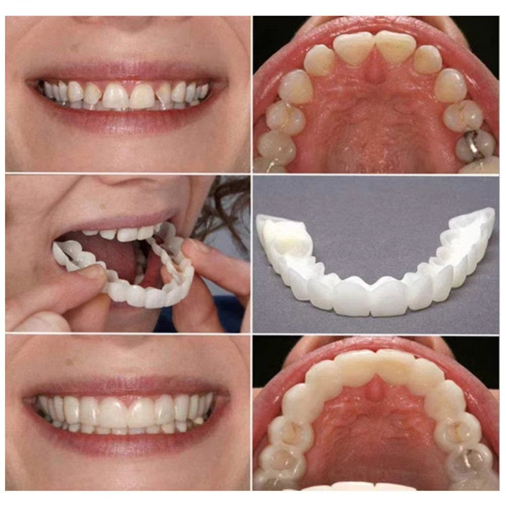 Snap-On Upper and Lower Dental Veneers Set - False Teeth Cover Silicone