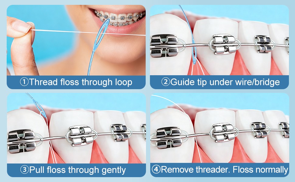 Dental Floss Aid for Braces & Retainers - 200 Count, Strong & Flexible