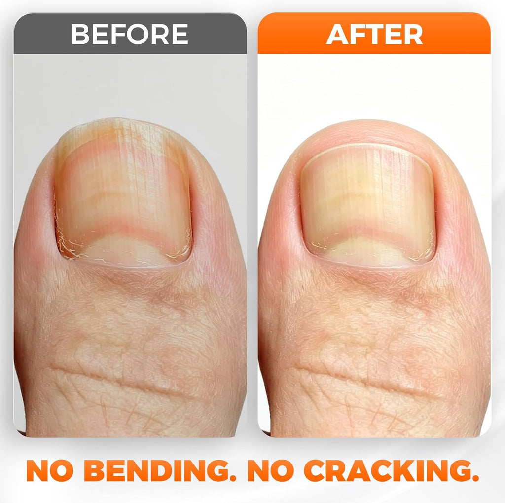 Heavy Duty Toenail Clippers for Seniors Thick Nails Angled Head Wide Jaw