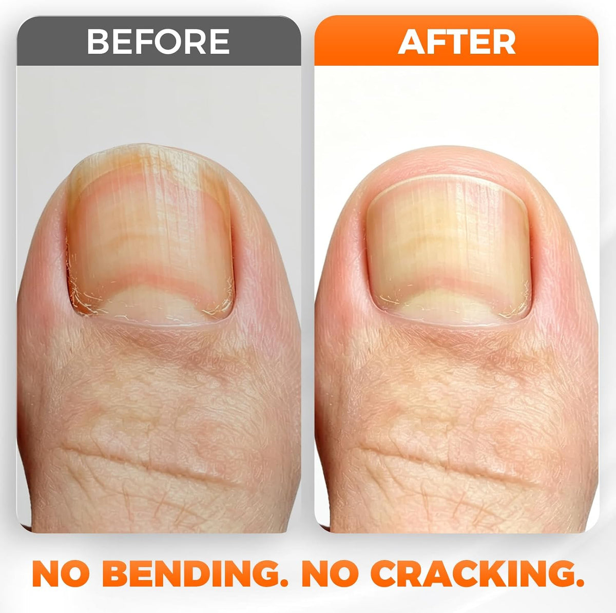 Heavy Duty Toenail Clippers for Seniors Thick Nails Angled Head Wide Jaw