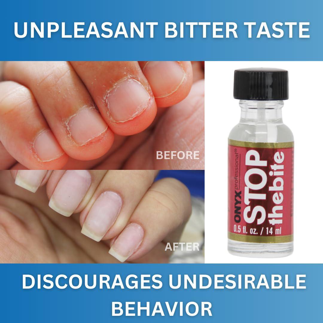 Onyx Stop the Bite Nail Biting Prevention Polish - Bitter Deterrent, Promotes Nail Growth, 0.5 Fl Oz
