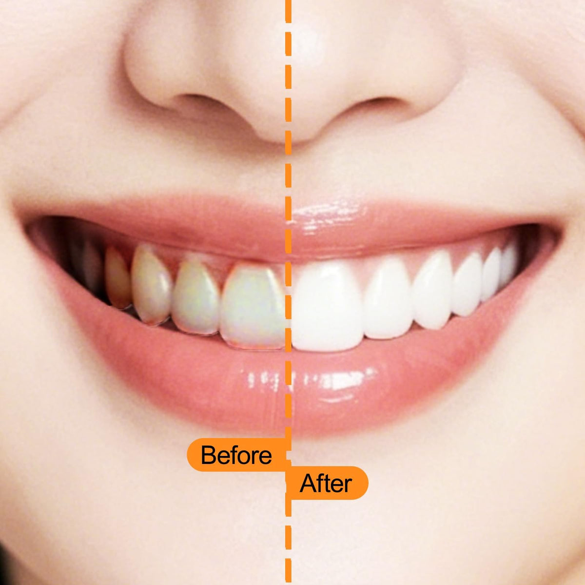 Interdental Braces Cleaning Brushes 180 Pack Soft Bristled Flossers for Oral Care