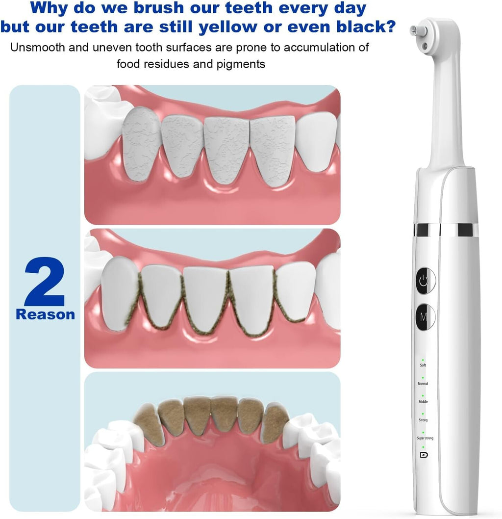 Professional Teeth Polishing Kit with USB Charging, 5 Speeds & Whitening Paste