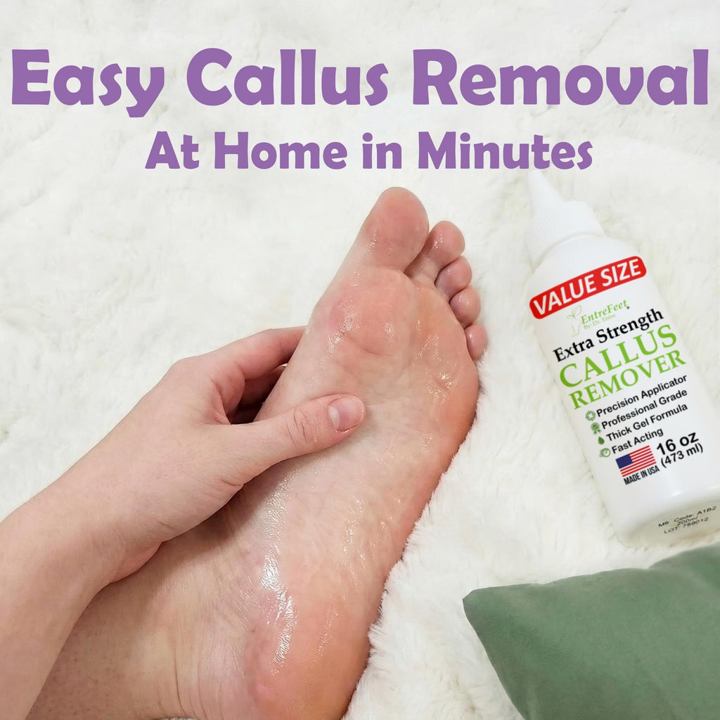 Extra Strength Foot Callus Remover Gel - 16 oz Professional Foot Care Treatment