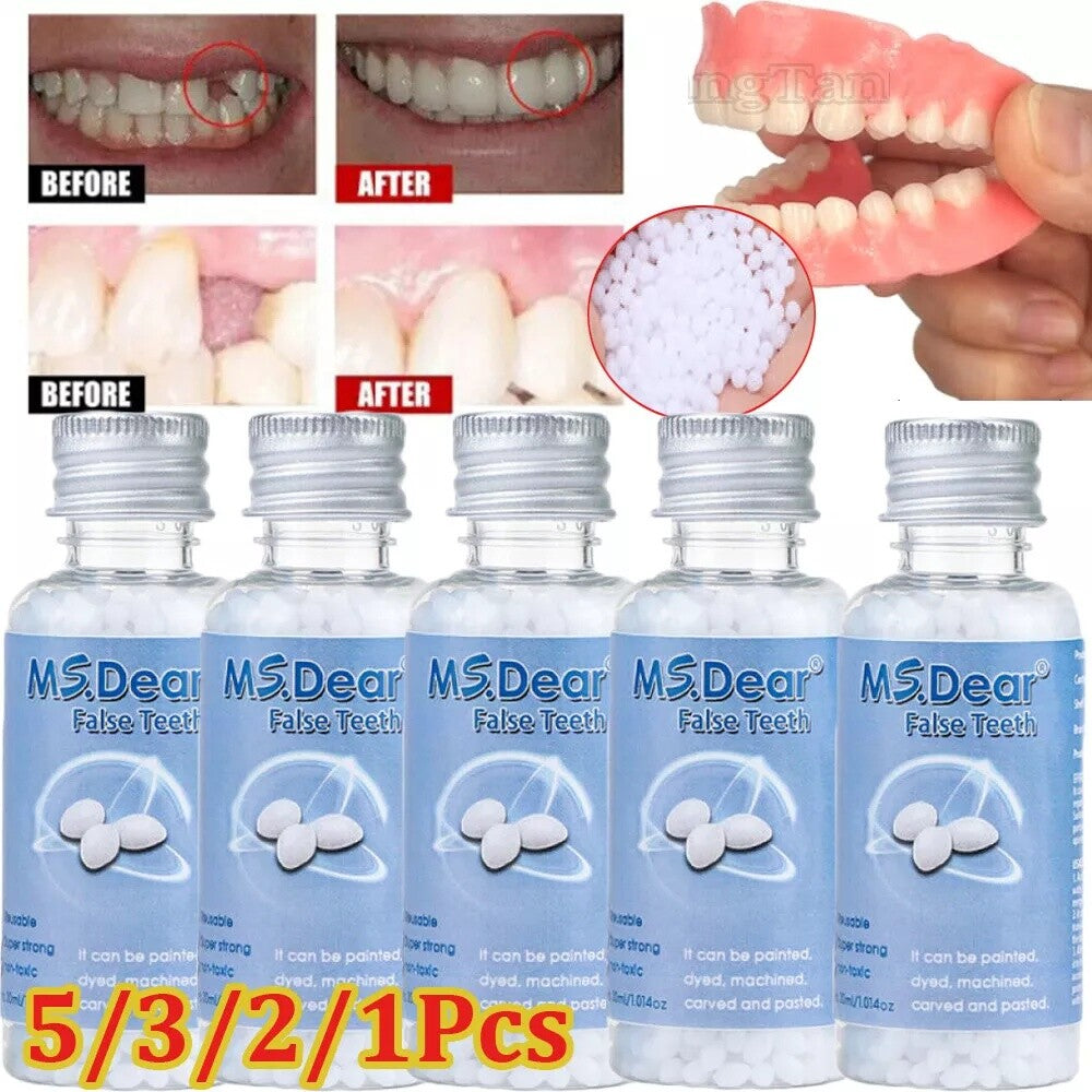 Temporary Dental Repair Kit for Broken Teeth & Cavities - Reusable Teeth Filler