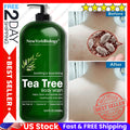 Antifungal and Antibacterial Body Soap for Ringworm and Skin Fungus