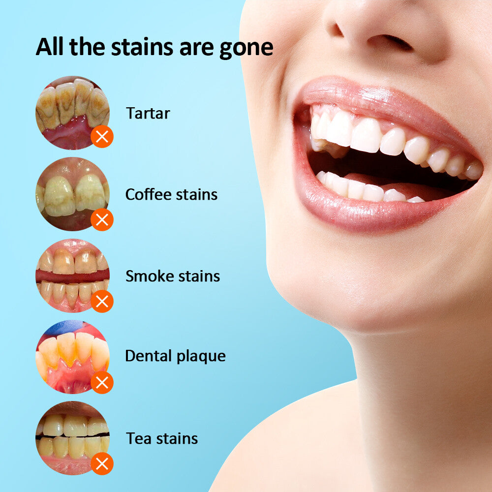 Electric Ultrasonic Tooth Cleaner Dental Scaler Tartar Remover