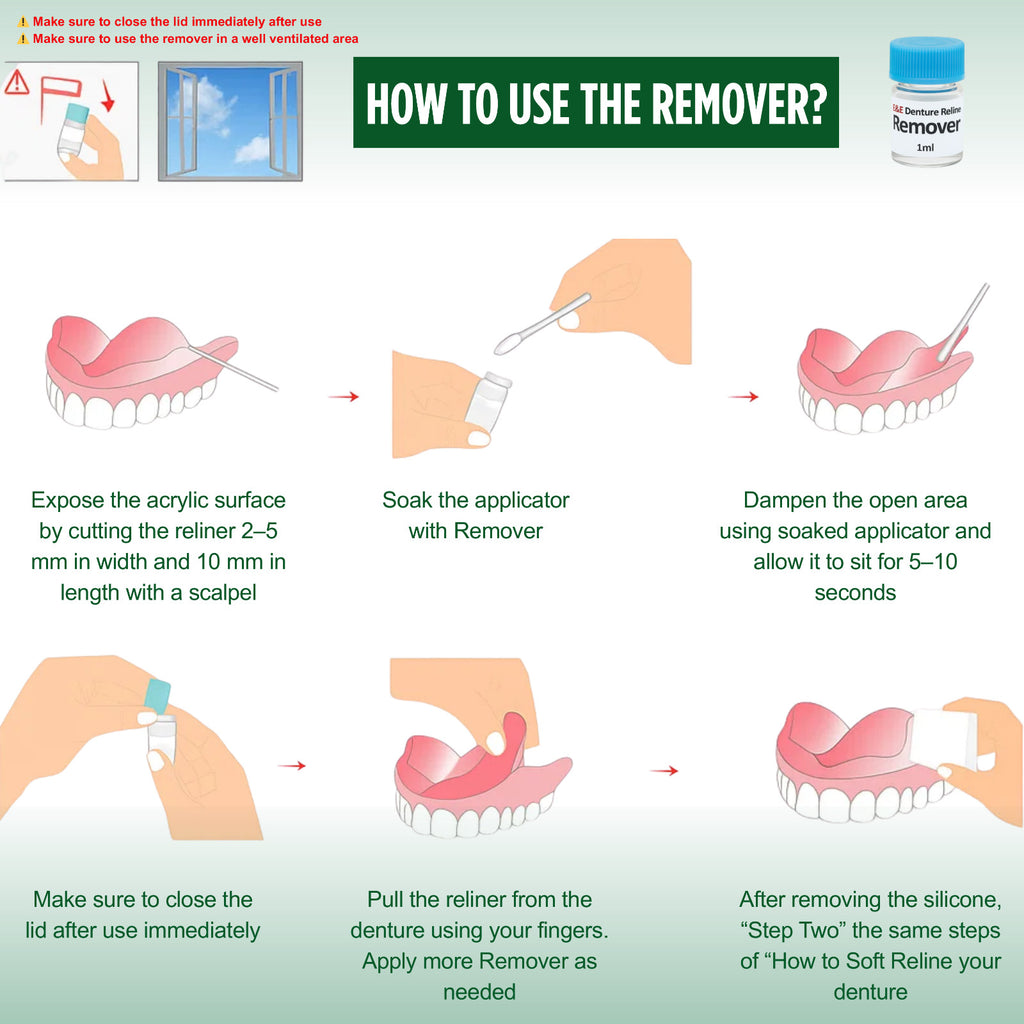Denture Soft Reline Kit for Comfortable Fit - Long-Lasting Cushion, Easy Application