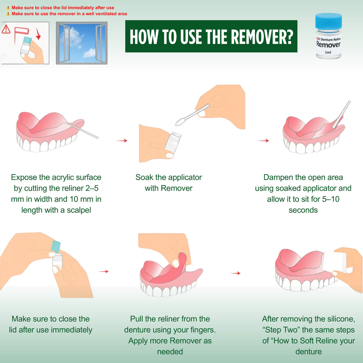 Denture Soft Reline Kit for Comfortable Fit - Long-Lasting Cushion, Easy Application