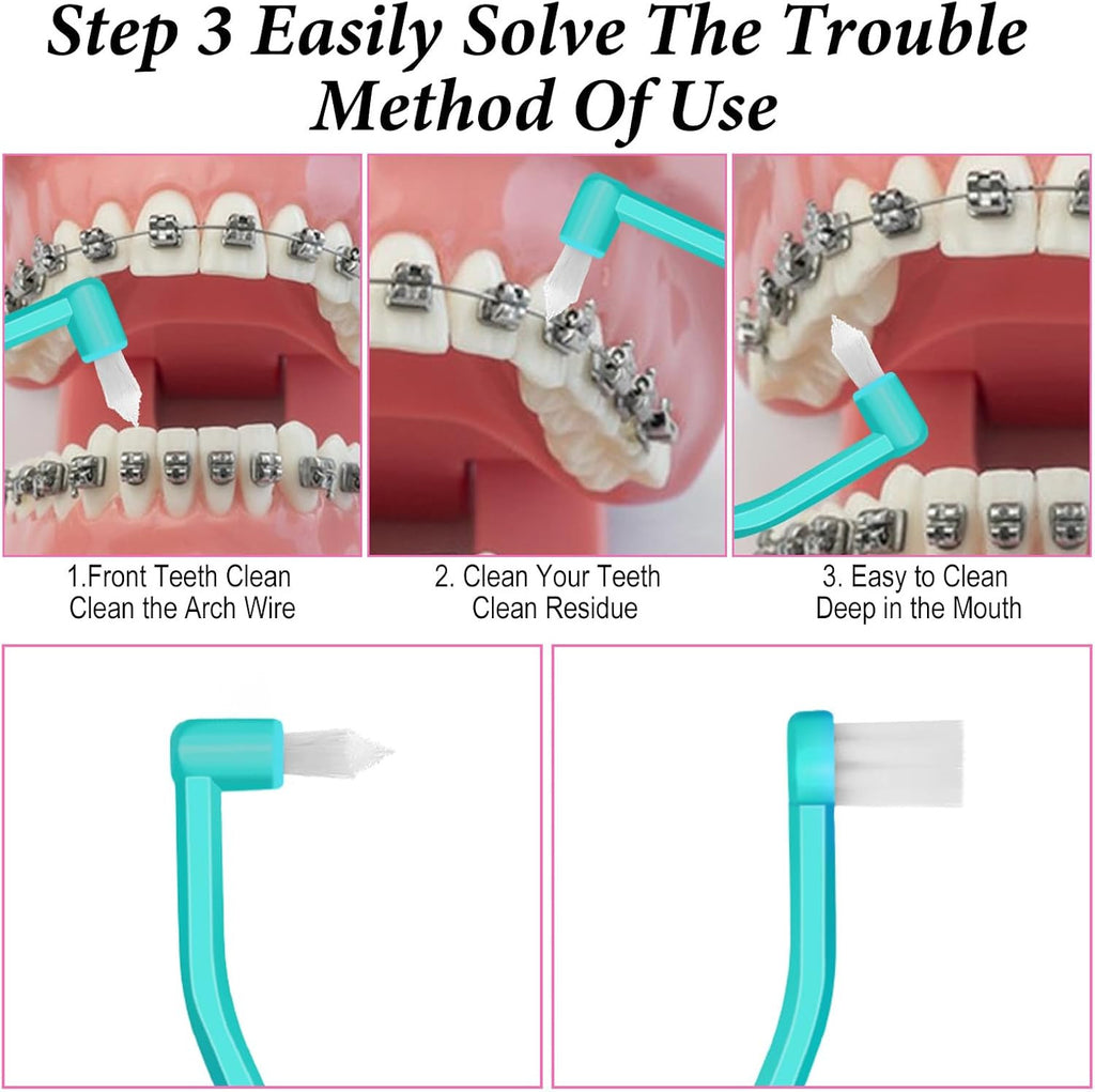 6 Pcs Small Head Orthodontic Interdental & Toothbrush Set for Deep Cleaning