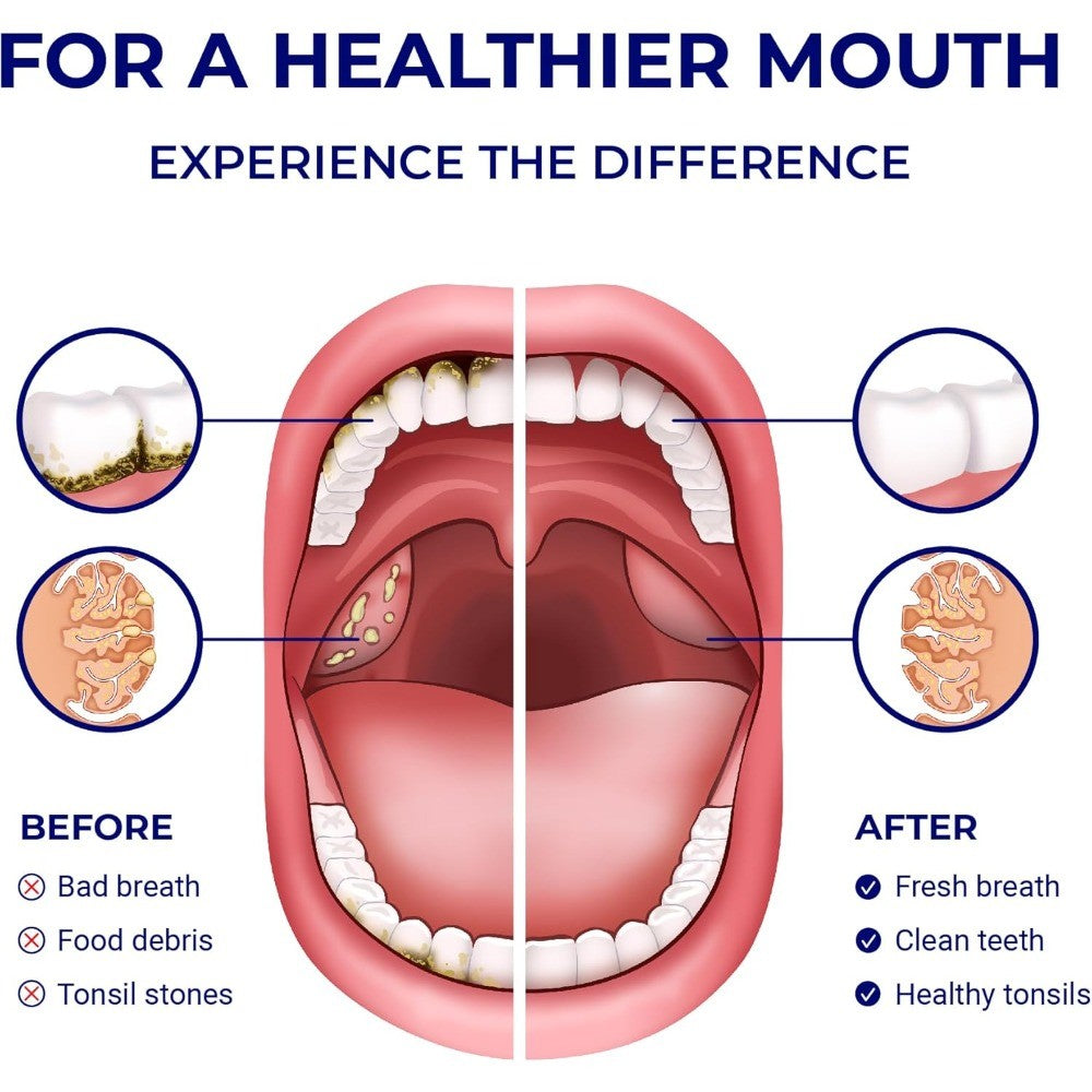 Gentle Oral Irrigator for Sensitive Teeth & Tonsil Stone Removal - Water Flosser