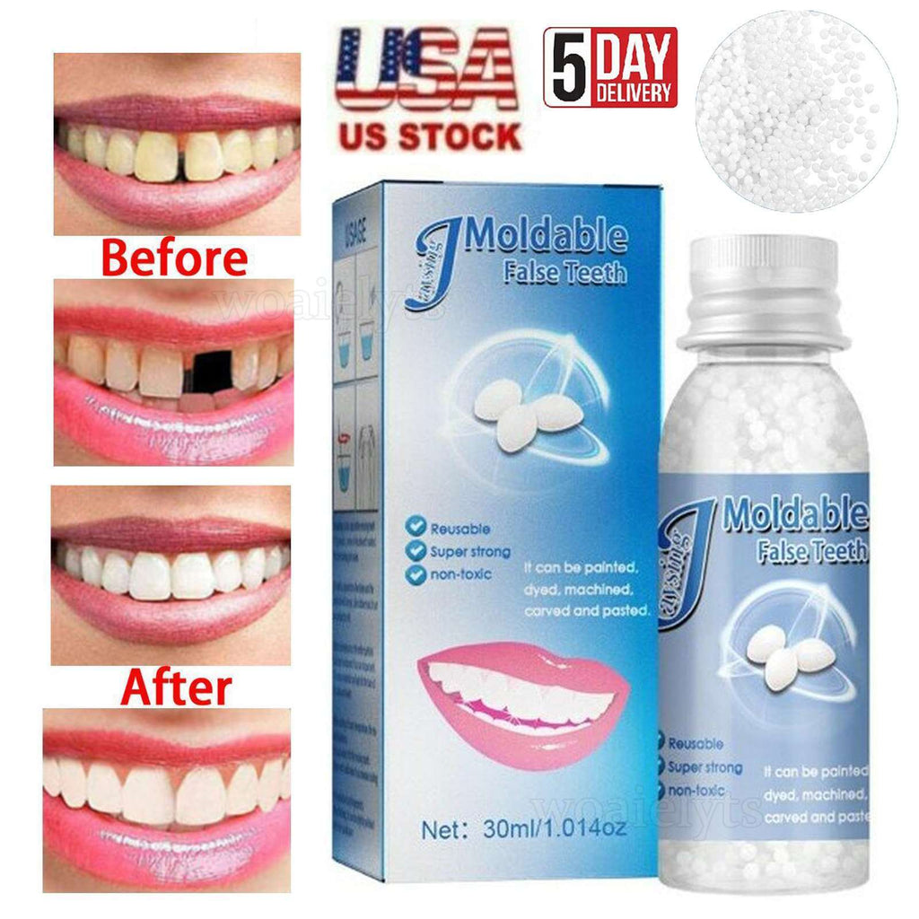 Reusable Moldable Teeth Repair Kit for Broken and Gaps - 30ml