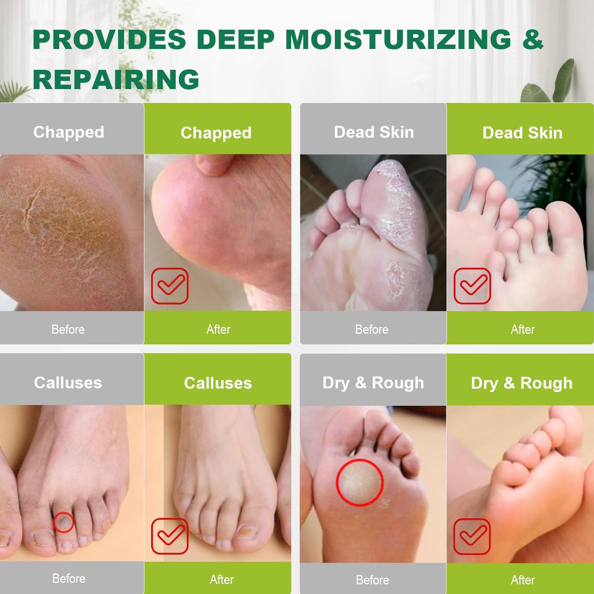 Disposable XL Foot Covers for Moisturizer & Spa Treatments, 300 Pack