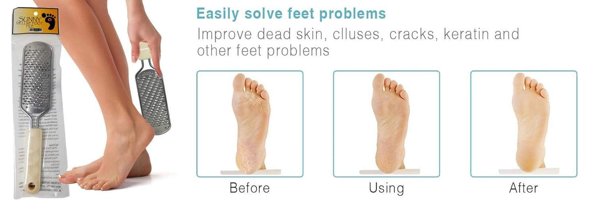 Pedicure Foot File Replacement Blades 3 Pack - Callus Remover Tools