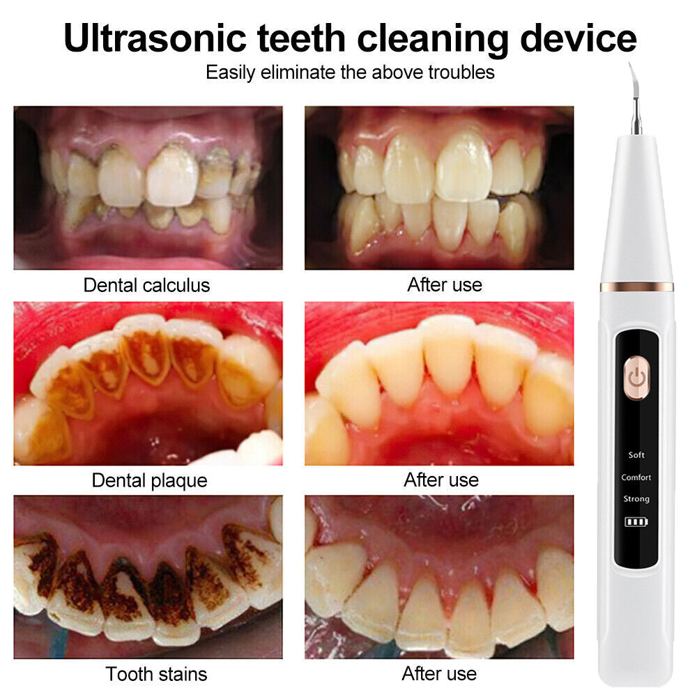 Electric Ultrasonic Dental Scaler for Teeth Cleaning & Stain Removal