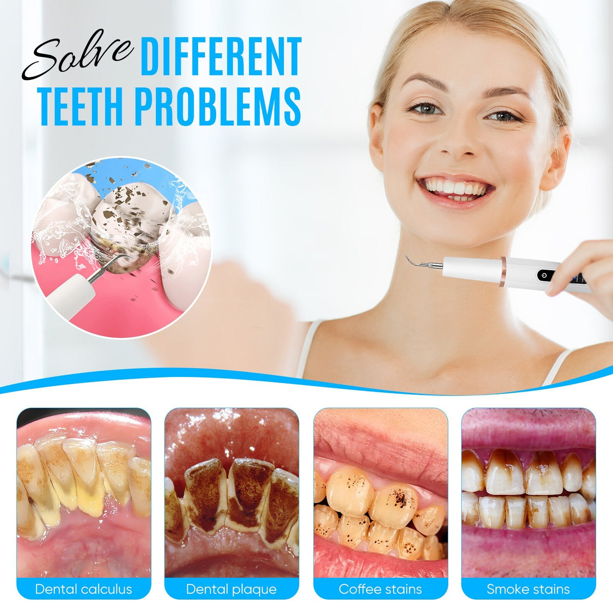 Rechargeable Ultrasonic Teeth Cleaning Kit for Plaque & Tartar Removal