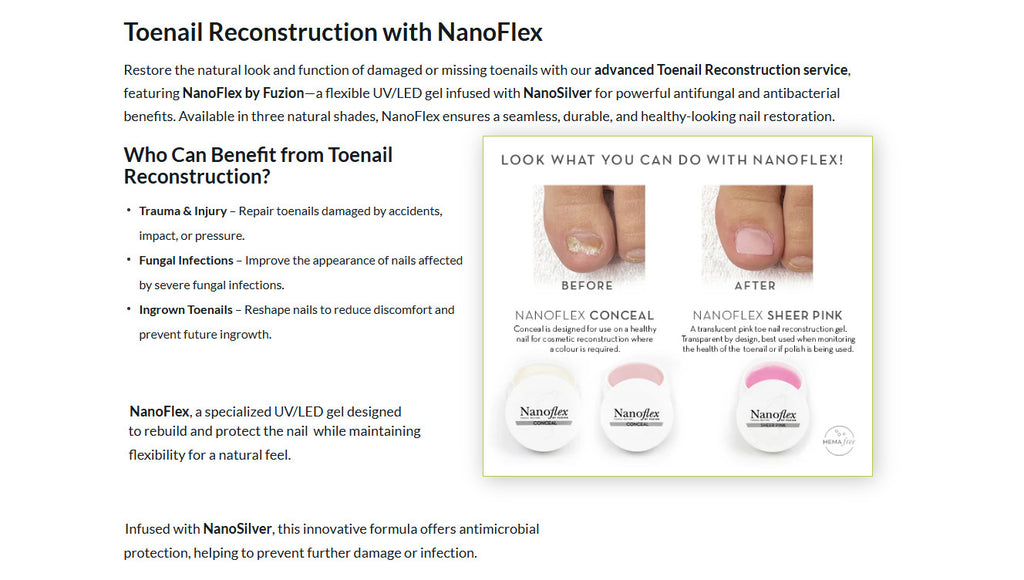 Fuzion UV/LED Nanoflex Toenail Concealer 12g - Natural Fungal Nail Treatment