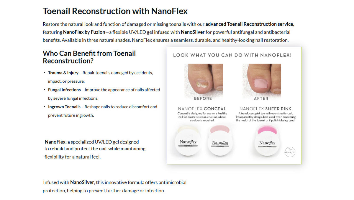 Fuzion UV/LED Nanoflex Toenail Concealer 12g - Natural Fungal Nail Treatment