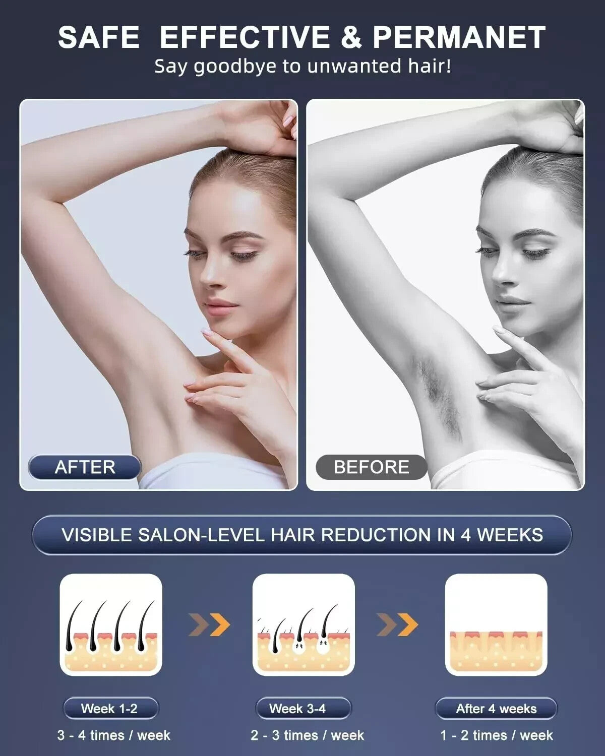 IPL Laser Hair Removal Device for Women & Men - Permanent At-Home System