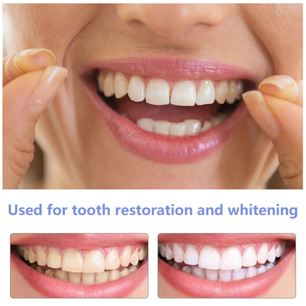 Snap-On Upper and Lower Dental Veneers Set - Reusable Teeth Cover for Adults