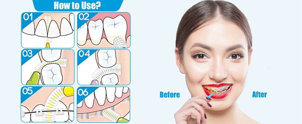 Dental Flossers with 3 Sizes & Colors, Gentle Interdental Toothpick Brushes