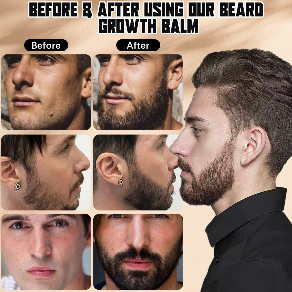 Beard Growth Serum - Ultra Potent Beard Stimulator with Natural Oils