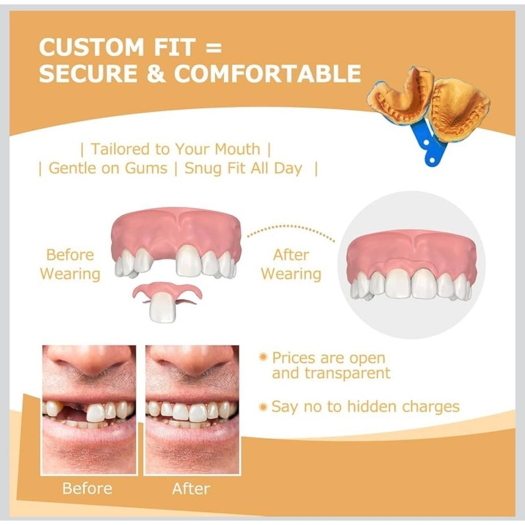 At Home Dental Impression Kit - Custom Denture Mold Starter Set