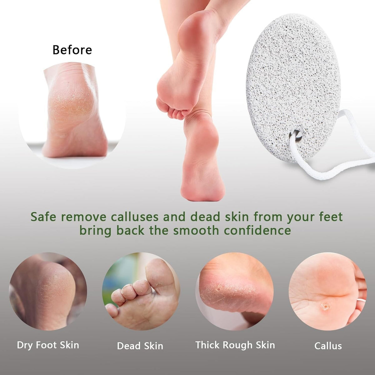 Natural Lava Pumice Stone for Feet Callus Remover & Dead Skin Exfoliation - 4 Pack