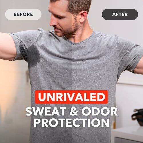 Clinical Strength Underarm Antiperspirant Wipes for Excessive Sweating – 10 Wipes