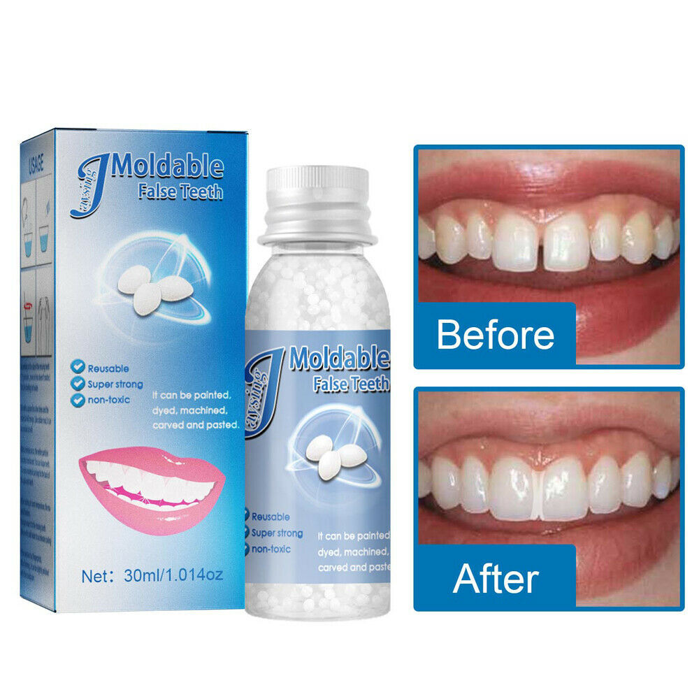 Dental Restoration Kit Moldable Bead for Filling and Repair - All Variants