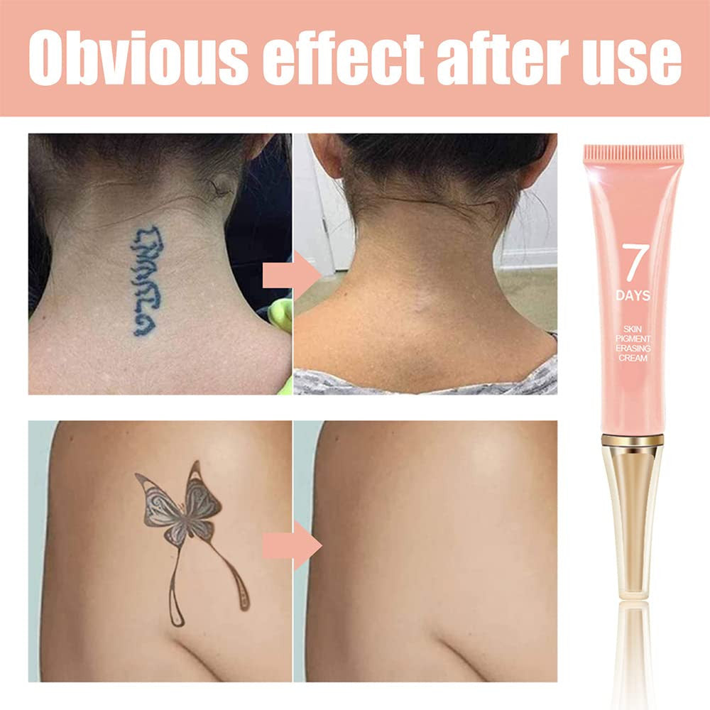 Tattoo Removal Cream That Works Fast – Permanent Ink Fade, Skin Moisturizing