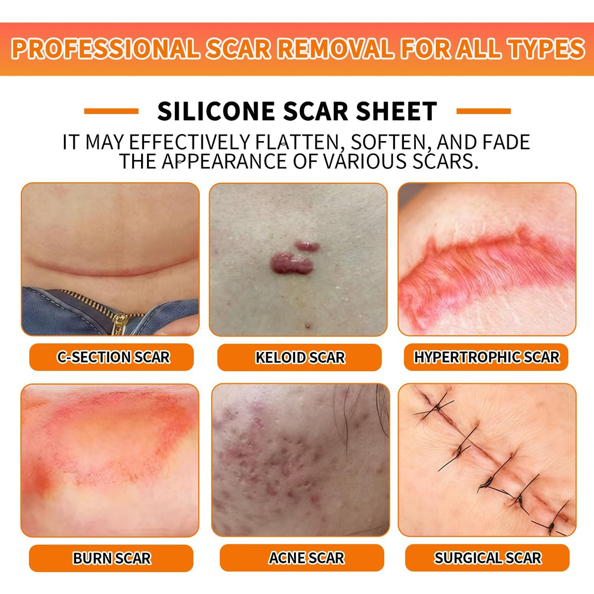 Silicone Scar Sheets Roll 1.6x60 Inches Medical Tape for Scar Removal