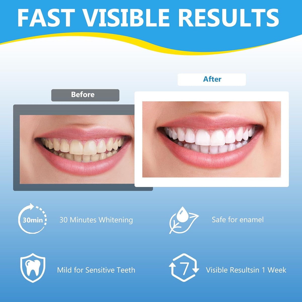 Sensitive Strips - 42 Dental Whitening Bands with Safe Antimancha Technology