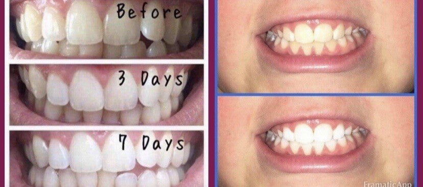 Whitening Fluoride Toothpaste with Vanilla Mint - 3.9 oz, Brighten & Protect